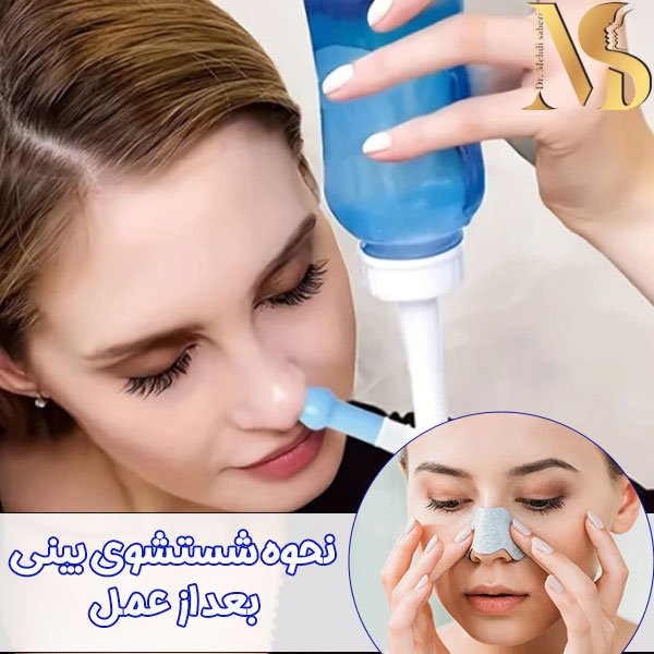 شستشوی بینی بعد از جراحی