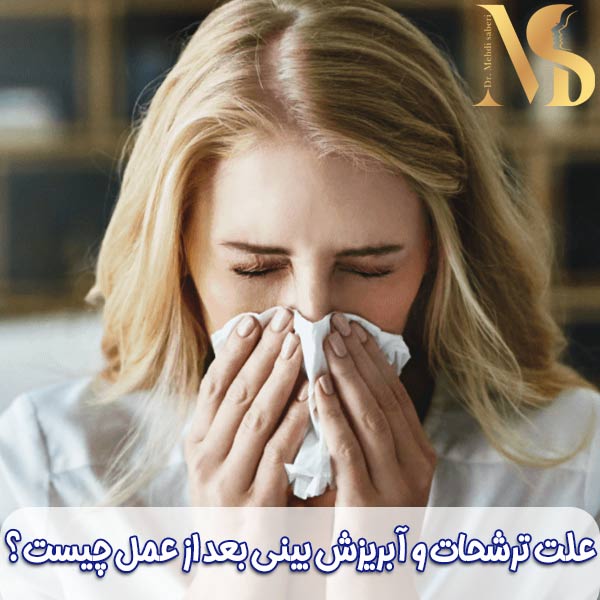 آبریزش بینی بعد عمل