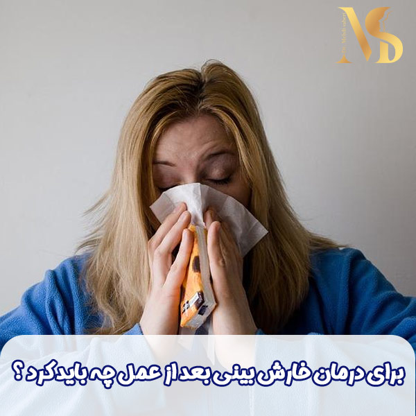 خارش بینی بعد از عمل