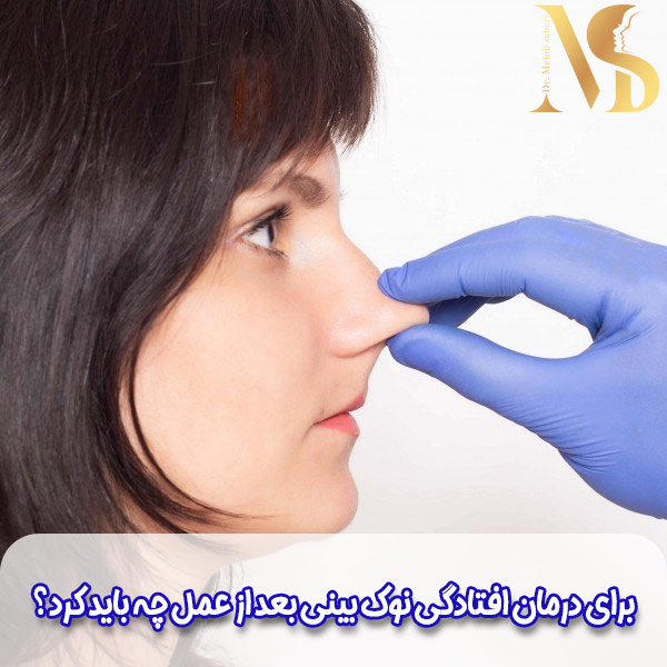 افتادگی نوک بینی بعد از عمل